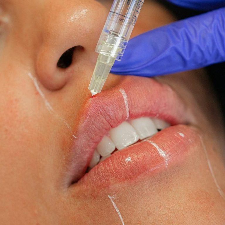 dermal-filler-course-greater-manchester.jpg
